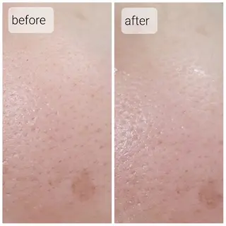 RICOA 酒井のマツエク・マツパデザイン