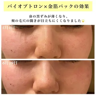 Bellesthe (ベルエステ)のエステ・リラクイメージ