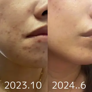 豊橋De'Im 安部のエステ・リラクイメージ