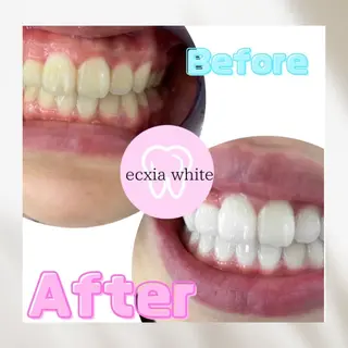 メンズ nanami -ホワイトニングのその他イメージ