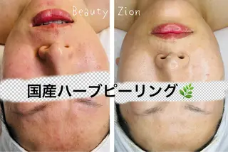 Beauty Zionのエステ・リラクイメージ