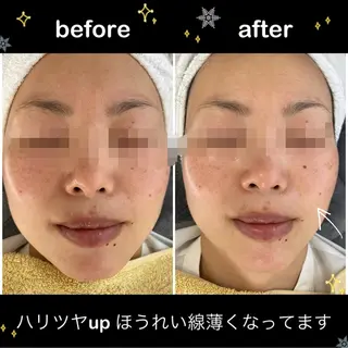 ビューティサロン プレジールOTAKEのエステ・リラクイメージ