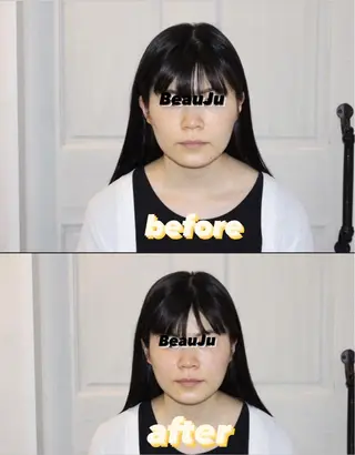 小顔矯/美容鍼/鍼灸 BeauJuのその他イメージ