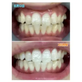 Ｍ渋谷 ホワイトニングのエステ・リラクイメージ