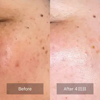 loa まつ毛と肌管理のお店のマツエク・マツパデザイン