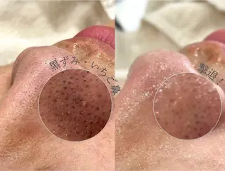 眉毛/毛穴ｹｱ 専門 nogi/Hottaの眉毛・アイブロウイメージ