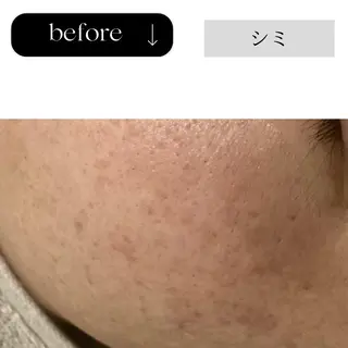 beauty CHOOSEのエステ・リラクイメージ