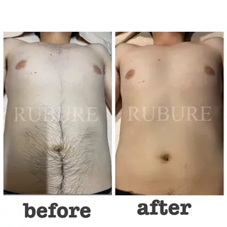 メンズ 都度払い脱毛サロン RUBURE千葉店のエステ・リラクイメージ