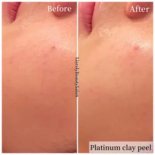 リアレリー 🪞🌹Ryokoのエステ・リラクイメージ