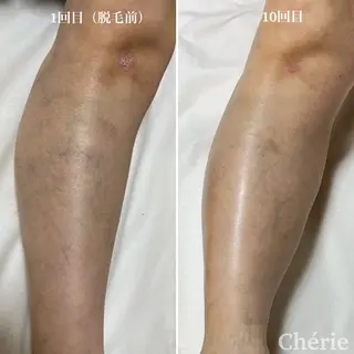 大津 香（シェリー）のエステ・リラクイメージ