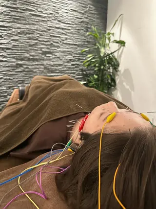 小顔矯/美容鍼/鍼灸 BeauJuのその他イメージ