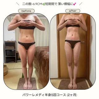 《本気痩せ×疲労改善 》  BILOOPのエステ・リラクイメージ