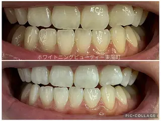 ホワイトニングビューティー東陽町店所属・ホワイトニング ビューティー東陽町店のその他イメージ