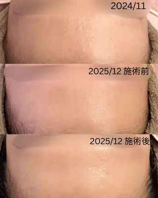 小顔&毛穴・肌質改善 LINDA西宮 AIのその他イメージ