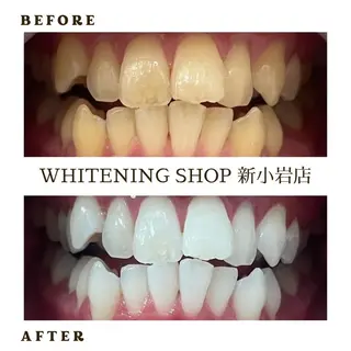 メンズ ホワイトニング ショップ新小岩店のその他イメージ