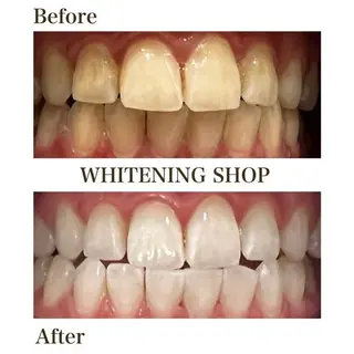 ホワイトニング ショップ伊丹店のその他イメージ