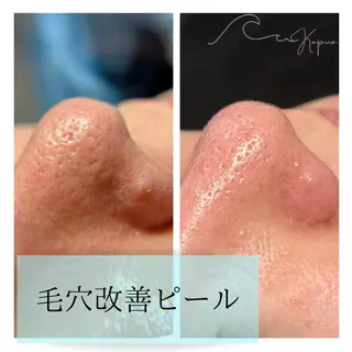 Kapua🌺 マユのマツエク・マツパデザイン