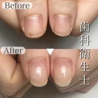 ネイル 深爪専門店 サロンリリーのネイルデザイン