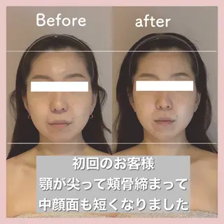 小顔矯正専門店Gémiey所属・越谷駅徒歩３分 小顔専門Gemieyのエステ・リラクイメージ