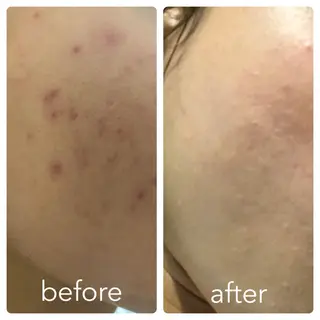 ナリス ビューティスタジオ De I'm所属・新田 彩乃のエステ・リラクイメージ