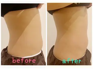 HappIness 遠赤外線ドームのエステ・リラクイメージ