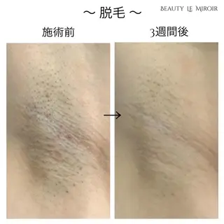 ビューティー ミロワールのエステ・リラクイメージ