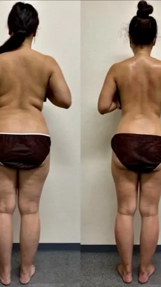 【二子玉川】 ビューティコアのエステ・リラクイメージ