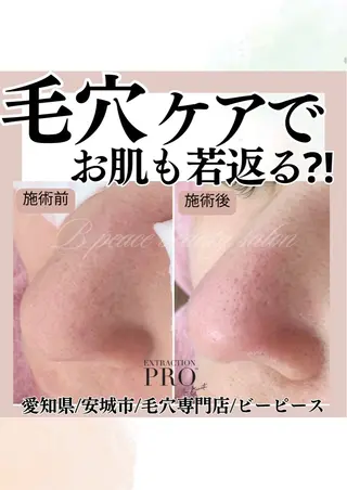 B peace. はるかのマツエク・マツパデザイン