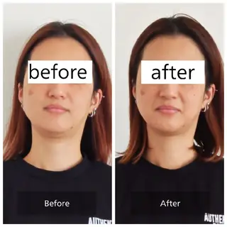 桜井市｜小顔・ 美容矯正 madoiのエステ・リラクイメージ