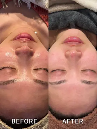 💎美容革命ラボ💎 大名店のエステ・リラクイメージ