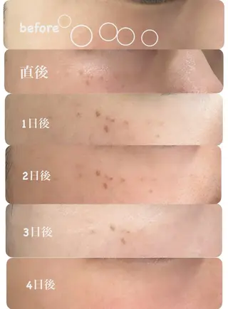 トータルしみケア専門 NICA(ニカ)の眉毛・アイブロウイメージ