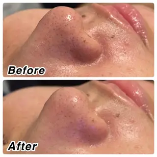 🌴Beauty Salon LANAのエステ・リラクイメージ