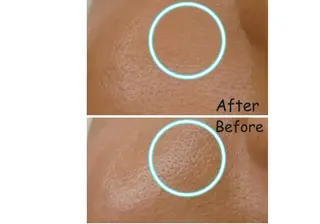 毛穴改善フェイシャル 夏秋美肌サロンのエステ・リラクイメージ