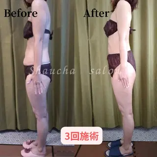 💎痩身エステサロン 💎シャウチャ奥多摩のエステ・リラクイメージ