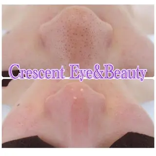 Crescent Beautyのエステ・リラクイメージ