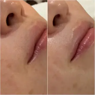 顔脱毛×エステサロン BLOOMi.の眉毛・アイブロウイメージ