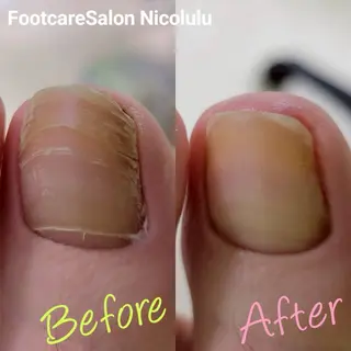 足トラブル専門 ニコルル金沢のエステ・リラクイメージ