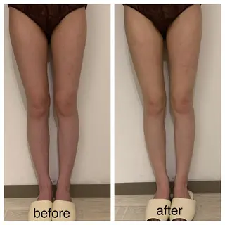 リンパマッサージ mimozaのエステ・リラクイメージ