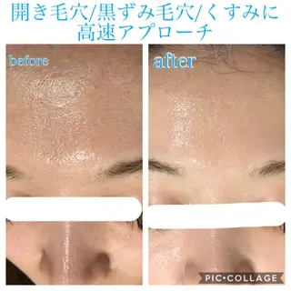 ロング カラー パーマ ヘアアレンジ キッズ ネイル マツエク・マツパ EnsorClair 代表 野口真央のエステ・リラクイメージ