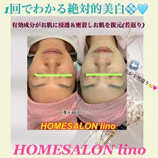 HOME SALON linoのエステ・リラクイメージ