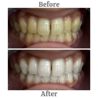 セルフホワイトニング　エクシア相模大野店所属・mo moのその他イメージ