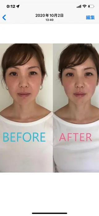 美容鍼灸サロン mahoroba院長のエステ・リラクイメージ