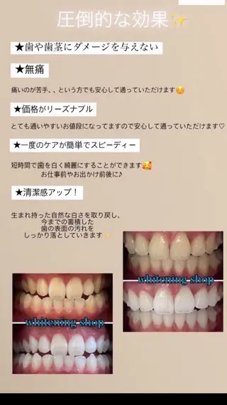 ホワイトニング ショップ津店のその他イメージ