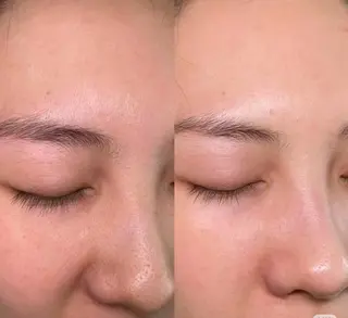 ネイル aliaハーブ水光店 エステティシャン募集のエステ・リラクイメージ