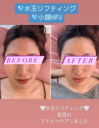 Tipani beaute'のエステ・リラクイメージ