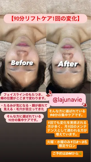 salon La•Junavie所属・[毛穴•肌質改善] フェイシャル専門のエステ・リラクイメージ