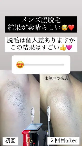 メンズ 肌育脱毛サロン LikoLinaのその他イメージ