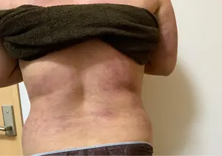 痩身/脱毛/ネイル HARUKAのエステ・リラクイメージ