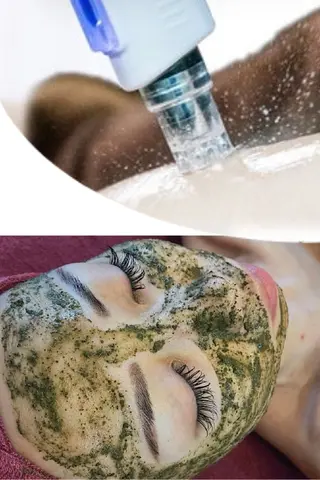 BELINDA ベリンダのその他イメージ