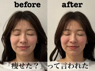 肌質改善×美容鍼 ゆいのエステ・リラクイメージ